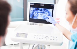 Dentist explaining x ray picture to patient